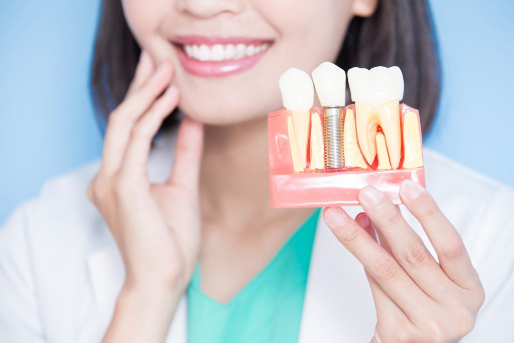 Woman holding a dental implant model with implant in the jawbone