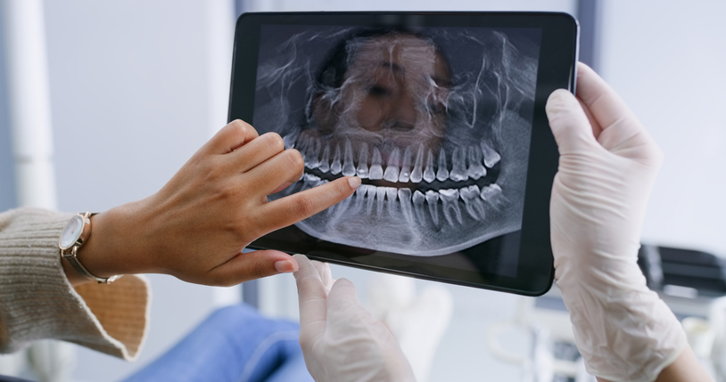 Dentist holding a tablet showing a digital X-ray to a patient.